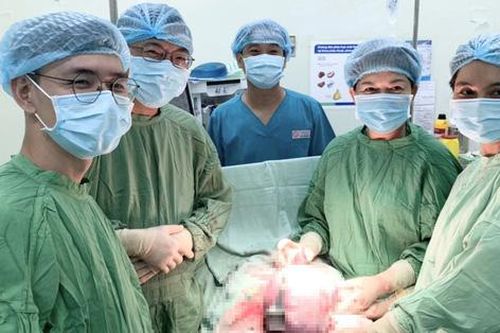 Mổ lấy thai kết hợp cắt u nang buồng trứng 'khủng'