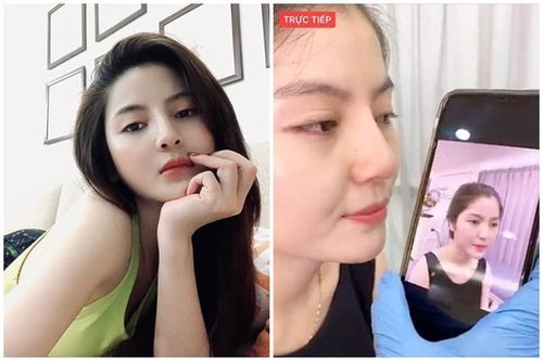 'Bạn gái tin đồn' của Quang Hải lộ ảnh trước phẫu thuật thẩm mỹ