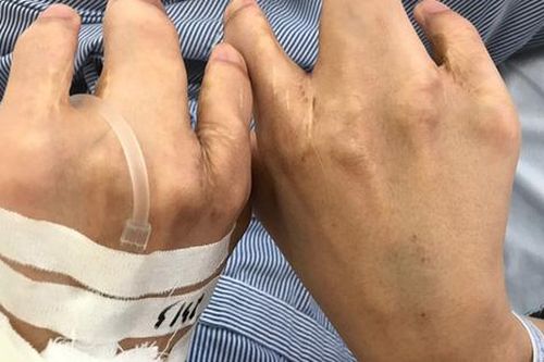 Nữ sinh 17 tuổi có phủ tạng đảo ngược, tim nằm bên phải