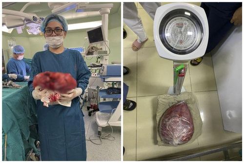 Cắt bỏ khối u nặng 10kg trong ổ bụng