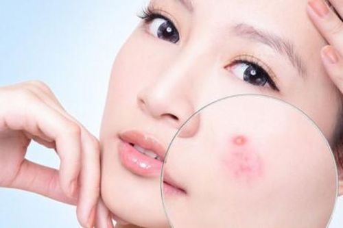 Bật mí 5 dấu hiệu chứng tỏ cơ thể bạn đang thiếu vitamin, canxi trầm trọng, cần bổ sung ngay