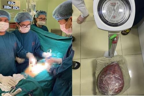Sự thật bất ngờ về người phụ nữ 'ai gặp cũng bảo mang bầu'