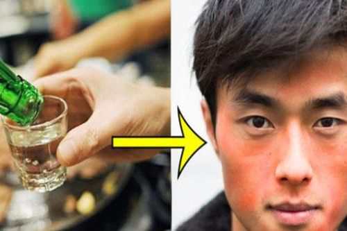 Đỏ mặt khi uống rượu bia: Đừng chủ quan vì đây là lời cảnh báo đầu tiên của căn bệnh vô cùng nguy hiểm