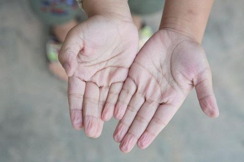Lý giải 5 hiện tượng trên cơ thể ai cũng biết nhưng không hiểu vì sao