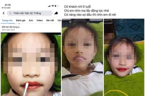Xôn xao thẩm mỹ viện phun môi cho... bé gái 5 tuổi