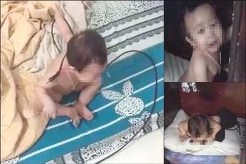 Bé gái 11 tháng tuổi bị cha ruột đánh đập dã man