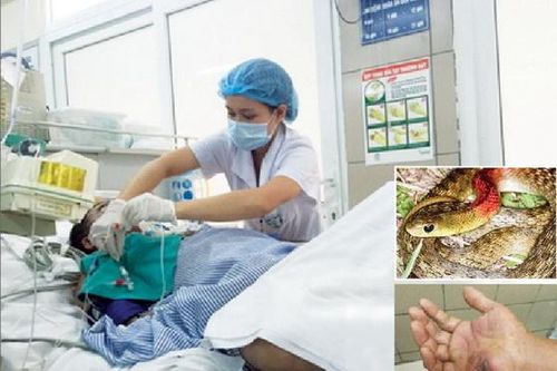 Suýt chết vì... rắn cảnh