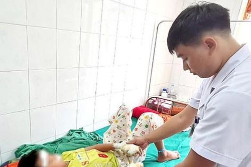 Pin phát nổ, thiếu niên 13 tuổi rách giác mạc, dập nát cả hai tay