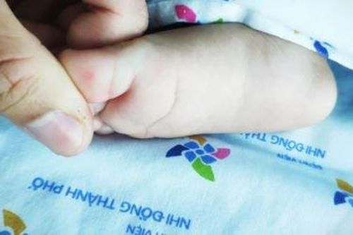 Bị nốt hồng ban nhỏ ở chân, không ngờ bé gái nửa tuổi phải lọc máu gấp