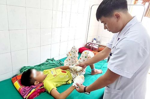 Bé 13 tuổi bị rách giác mạc, dập nát 2 bàn tay do pin phát nổ