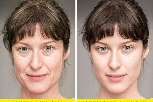 Ngủ không dùng gối: Điều kỳ diệu gì xảy ra với làn da?