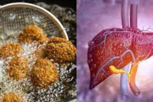 4 món ăn gây hại gan hàng đầu được WHO liệt vào 'danh sách đen', người Việt vẫn vô tư ăn mỗi ngày