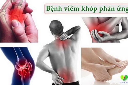 Chữa trị sớm viêm khớp phản ứng để tránh biến chứng