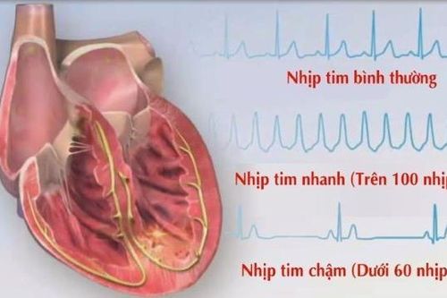 Không nên quá lo lắng về bất lợi của thuốc