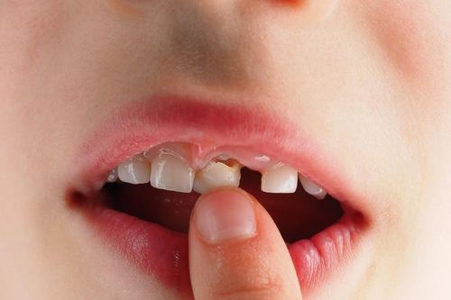 Bé trai tại Trung Quốc nguy kịch sau khi nhổ răng