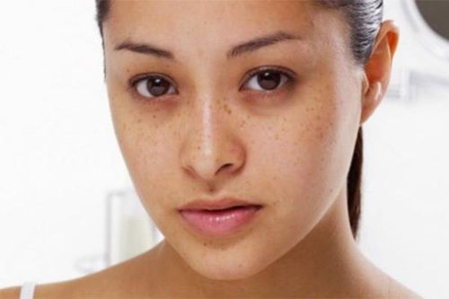 Bí quyết xóa tan quầng thâm mắt tại nhà