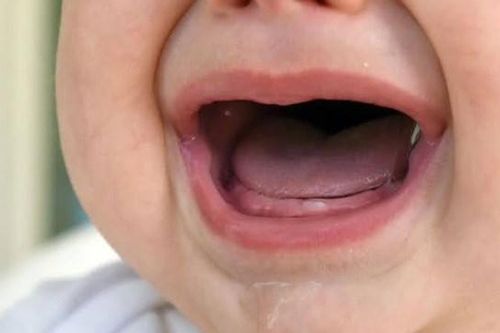 Dấu hiệu trẻ đi tướt mọc răng và cách xử lý