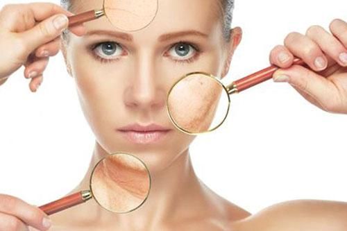 Da hỗn hợp cần có cách chăm sóc riêng