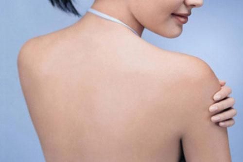 Cách chăm sóc da vùng lưng đơn giản tại nhà