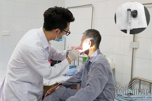 'Bắn' 10 điếu thuốc lào mỗi ngày, người đàn ông mọc u lệch mặt