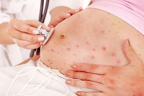 Ngứa khi mang thai, cần làm gì?