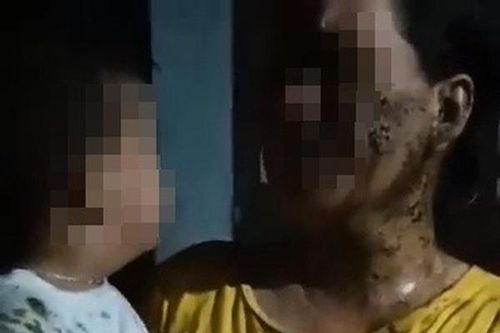Xác minh hành động đổ phân lên người bé 2 tuổi để đòi nợ