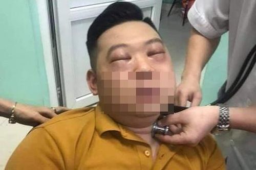 Nam thanh niên ở Phú Thọ bị sốc phản vệ do thái hành