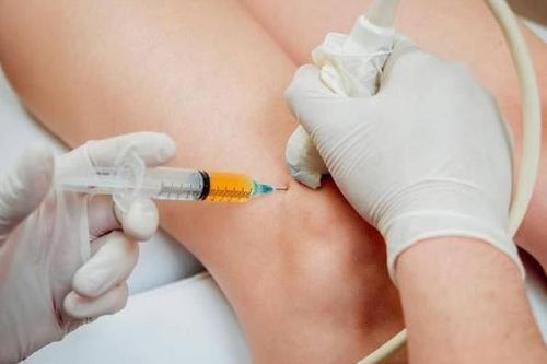 Tiêm corticoid vào khớp: Nên hay không?