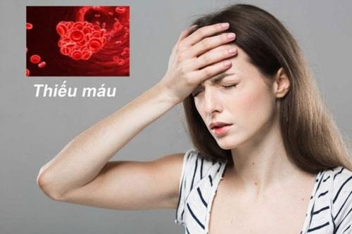 Đừng chủ quan với quầng thâm dưới mắt bởi cơ thể bạn đang bị báo động bởi 5 vấn đề sức khỏe sau