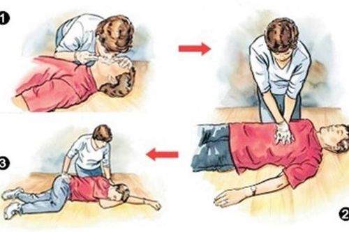 Sơ cứu đuối nước đúng cách, ai cũng cần biết