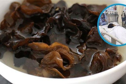 Người phụ nữ tử vong vì một sai lầm khi ăn mộc nhĩ