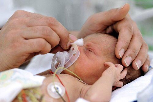 Rubella: Tìm hiểu nguyên nhân gây hội chứng Rubella bẩm sinh
