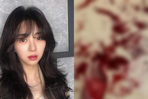 Mina (AOA) đăng ảnh cổ tay đầy máu, khẳng định: 'Các người chẳng biết gì về tôi cả'