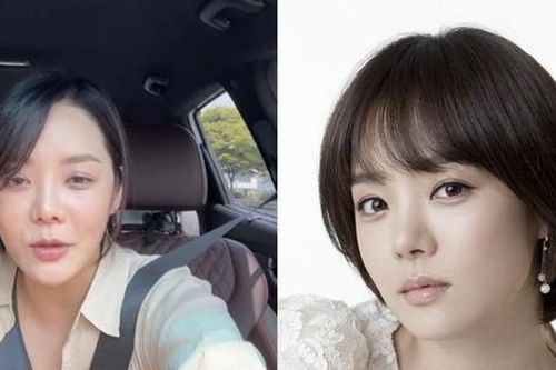 Chae Rim lộ gương mặt cứng đơ, còn đâu nữ thần ngọt ngào khiến fan một thời thương nhớ