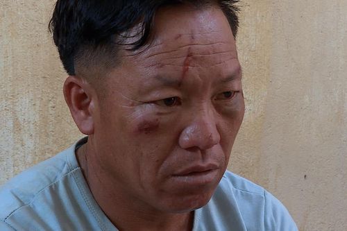 Truy bắt tội phạm ma túy, 2 chiến sỹ công an bị thương