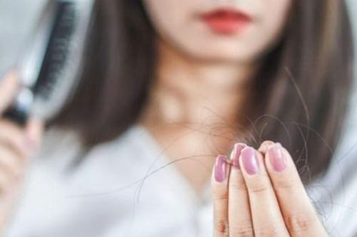 Người phụ nữ 'bỗng dưng' hói nửa đầu vì bệnh cực hiếm