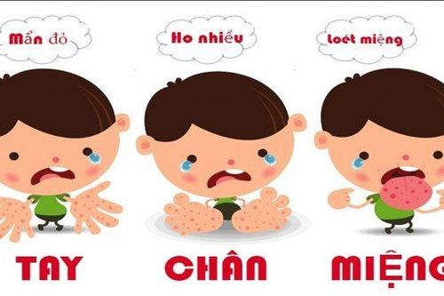 Ngừa biến chứng bệnh tay chân miệng
