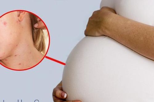 Bà bầu sốt do rubella cần làm gì để hạ?