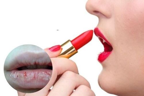 Thiếu nữ 'gặp họa' vì mua son trên mạng