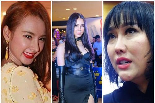 Những sao Việt khổ sở sau phẫu thuật thẩm mỹ