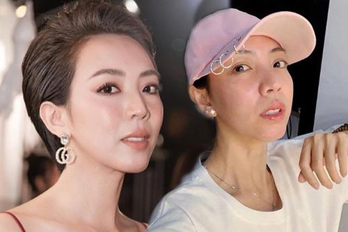 Thu Trang tiêm mỡ lên mặt, giờ trẻ đẹp đúng chuẩn Hoa hậu làng hài