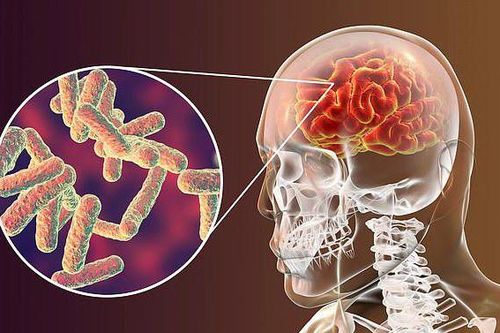 Nguy hiểm biến chứng não do bệnh Rubella và những thông tin quan trọng