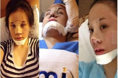 Khoe ảnh chụp 'cam thường', bà Tưng bị 'đào mộ' phẫu thuật thẩm mỹ