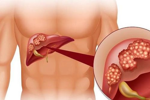 Kỳ lạ loài cây có hạt độc, nhưng thân và lá trị viêm gan có vi rút hiệu quả
