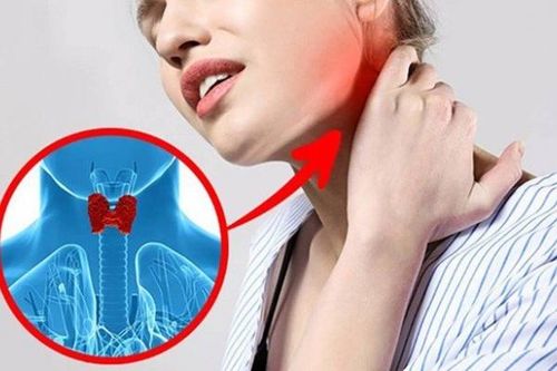Bài thuốc hỗ trợ điều trị cường tuyến giáp
