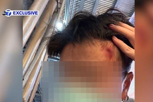 Người phụ nữ gốc Á bị đập búa vào đầu giữa phố ở Mỹ