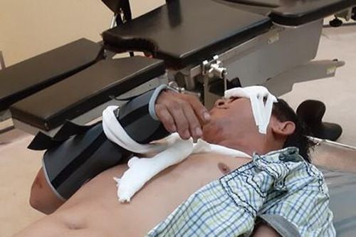 Say xỉn té xe, 2 'bợm nhậu' tung tin bị côn đồ chặn đánh vì sợ mẹ mắng