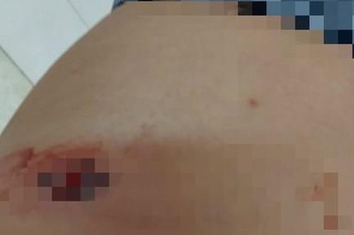 Nghi mâu thuẫn tiền bạc, người đàn ông bị bắn nhiều phát ở Sài Gòn