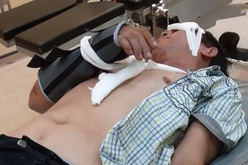 Nhậu say té xe bất tỉnh, báo Công an bị 'tập kích' đánh hội đồng