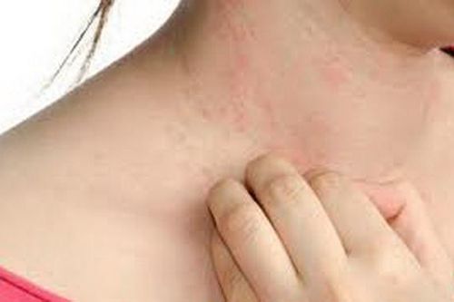 COVID-19: 8 dấu hiệu trên da không thể bỏ qua